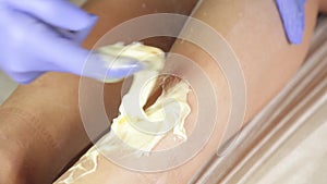 Beautician remov unwanted leg hair with shugaring. Epilation process