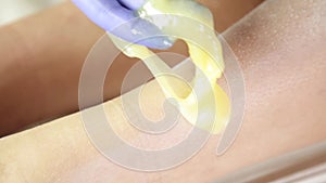 Beautician remov unwanted leg hair with shugaring. Epilation process