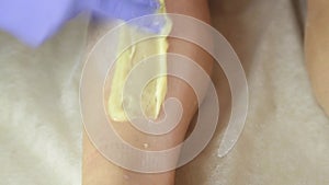 Beautician remov unwanted leg hair with shugaring. Epilation process