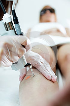 The beautician`s hands removing leg hair with a laser to her client in the beauty salon.