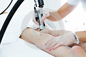 The beautician`s hands removing leg hair with a laser to her client in the beauty salon.