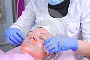 Beautician washes cotton pads chemical peeling from the patient`s face. Cleaning the face skin and lightening freckles