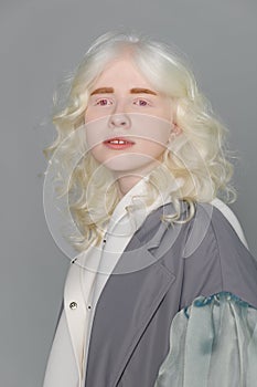 Beautiful albino girl with white skin, natural lips and white hair