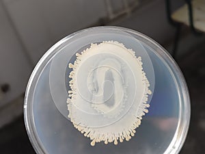 A beautiful bacterial growth in a petri plate dish with nutrient agar medium