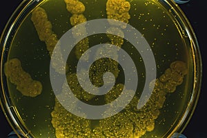 Beautiful colorful bacterial culture in petri dish laboratory fungus and bacteria