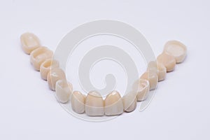 Beautiful dental bridge isolated on wite made of ceramic porcelain. Aesthetic restoration of tooth loss. Ceramic