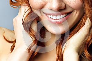 Beautiful female smile after teeth whitening procedure. Dental care. Dentistry concept