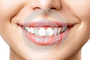 Beautiful female smile after teeth whitening procedure. Dental care. Dentistry concept