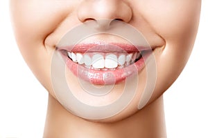 Beautiful female smile after teeth whitening procedure. Dental care. Dentistry concept photo