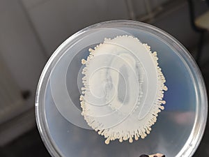 A beautiful fractal pattern bacterial colony in a petri plate dish with nutrient agar medium