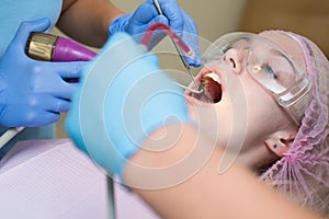 Beautiful girl in dental chair on the examination at dentist. Woman showing her perfect straight white teeth. Technology
