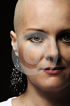 Beautiful middle age woman cancer patient without hair