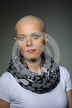 Beautiful middle age woman cancer patient without hair