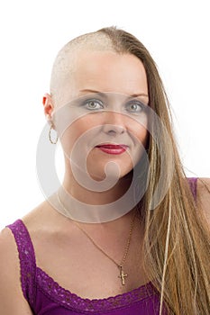 Beautiful middle age woman cancer patient without hair