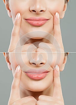 Beautiful pink lips after filler injection collagen to increase