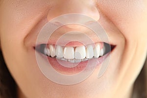 Beautiful smile with great healthy white teeth close up.