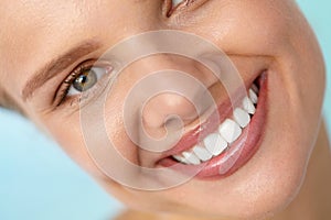 Beautiful Smile. Smiling Woman Face With White Teeth, Full Lips
