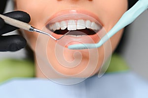 Beautiful Smile With White Teeth. Closeup Of Smiling Woman Mouth With Natural Plump Full Lips And Healthy Perfect Smile