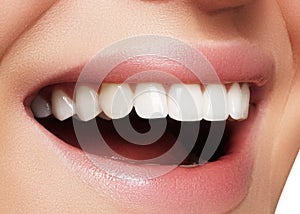 Beautiful smile with whitening teeth. Dental photo. Macro closeup of perfect female mouth, lipscare rutine