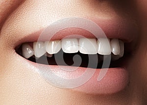 Beautiful smile with whitening teeth. Dental photo. Macro closeup of perfect female mouth, lipscare rutine