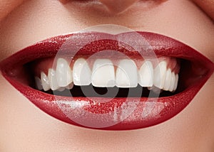 Beautiful smile with whitening teeth. Dental photo. Macro closeup of perfect female mouth, lipscare rutine