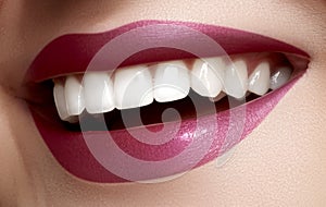 Beautiful smile with whitening teeth. Dental photo. Macro closeup of perfect female mouth, lipscare rutine