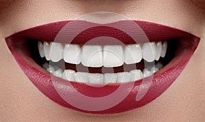 Beautiful Smile with Whitening Teeth. Dental Photo. Macro Closeup of Perfect Female Mouth, Lipscare or Tooth Care Rutine