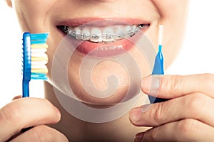 Beautiful smiling girl with retainer for teeth brushing teeth