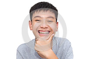 Beautiful smiling of handsome boy with teeth brace dental.