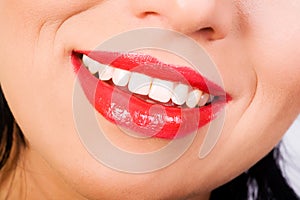 Krásný bílé zuby úsměv 