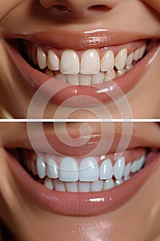 Beautiful wide smile of a young fresh woman with white healthy teeth