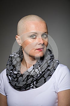 Beautiful woman cancer patient without hair