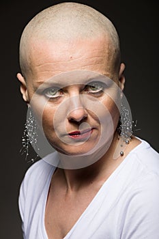 Beautiful woman cancer patient without hair