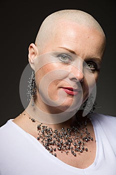 Beautiful woman cancer patient without hair