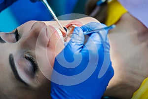 Beautiful woman at the dentist in prophylaxis session