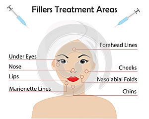 Beautiful woman with filler, Botox treatment area on facial face.