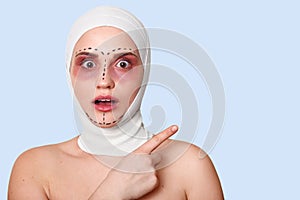 Beautiful woman before plastic surgery with bandaged face. Girl looks shocked, points fore finger aside, with opened mouth and