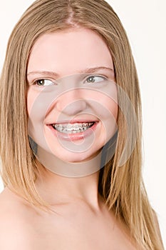 Beautiful young girl with brackets on teeth