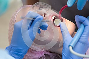 Beautiful young woman with healthy teeth on white background. Close-up portrait of a female patient visiting dentist for