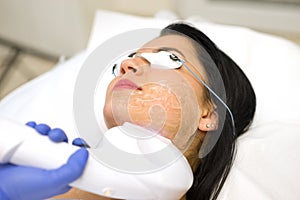 Beautiful young woman lying on a table with protect glasses on eyes getting a laser skin treatment