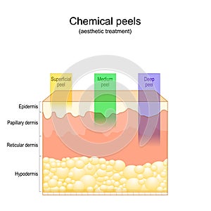 Beauty aesthetic treatment. Chemical peels