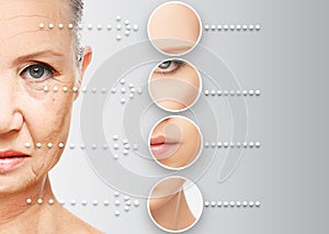 Beauty concept skin aging. anti-aging procedures, rejuvenation, lifting, tightening of facial skin