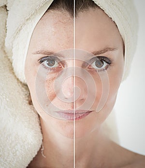 Bellezza pelle cura approccio ringiovanimento sollevamento stringendo da facciale pelle 
