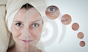 beauty concept - skin care, anti-aging procedures, rejuvenation, lifting, tightening of facial skin