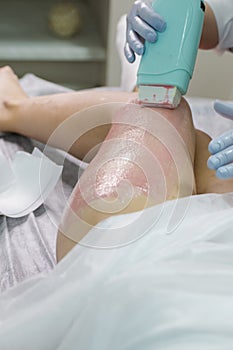 Beauty and Healthcare. Close-up Of A Beautician Doing Depilation With Hot Wax On Woman`s Leg Using Wax Device In Spa