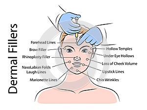 Beauty Injections Infographics Scheme photo