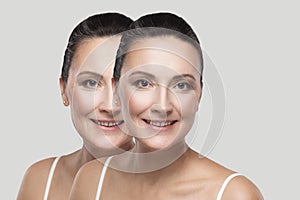 Before and after beauty skin wrinkles treatment procedure