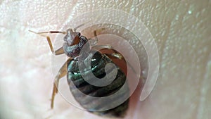 Bedbug sitting on human skin