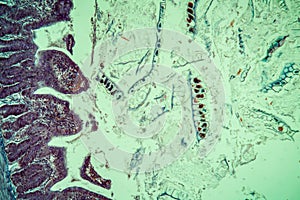 Bee amoebic dysentery