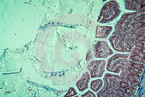 Bee amoebic dysentery